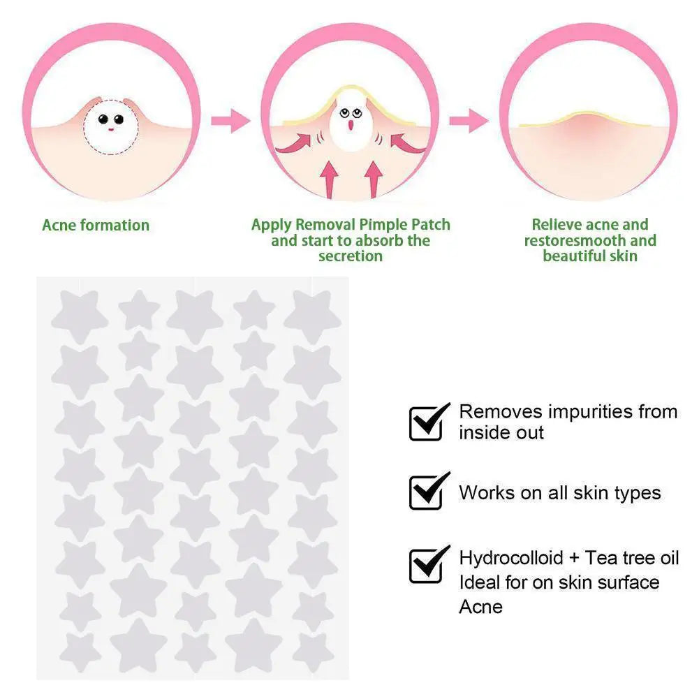 LuxeSkin Lab Acne Patches — 40 Pack